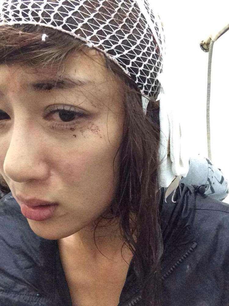 明星整容毀容最嚴(yán)重的是誰，深度探討與反思，深度探討與反思，哪位明星整容遭遇最慘重的毀容？